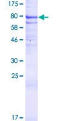 Novus Biologicals Recombinant Human DISP1 GST (N-Term) Protein 10 &mu;g | Buy Online | Novus Biologicals&trade; | Fisher Scientific