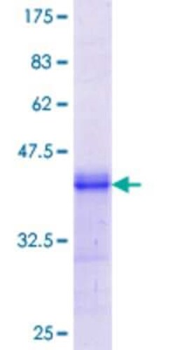 Novus Biologicals Recombinant Human DISP1 GST (N-Term) Protein 25 &mu;g | Buy Online | Novus Biologicals&trade; | Fisher Scientific