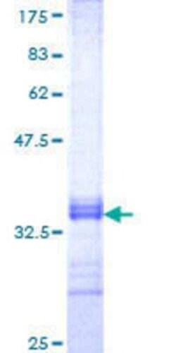 Novus Biologicals Recombinant Human USP45 GST (N-Term) Protein 10 &mu;g | Buy Online | Novus Biologicals&trade; | Fisher Scientific