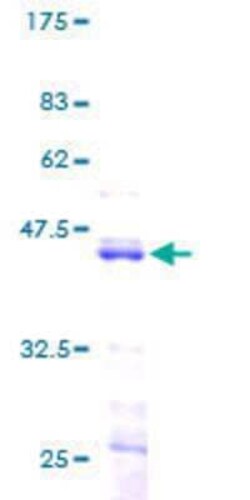 Novus Biologicals Recombinant Human HIST1H2BK GST (N-Term) Protein 2 &mu;g | Buy Online | Novus Biologicals&trade; | Fisher Scientific