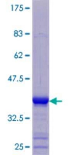 Novus Biologicals Recombinant Human KRTAP3-3 GST (N-Term) Protein 25 &mu;g | Buy Online | Novus Biologicals&trade; | Fisher Scientific