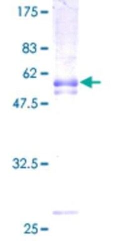 Novus Biologicals Recombinant Human PAQR8 GST (N-Term) Protein 2 &mu;g | Buy Online | Novus Biologicals&trade; | Fisher Scientific