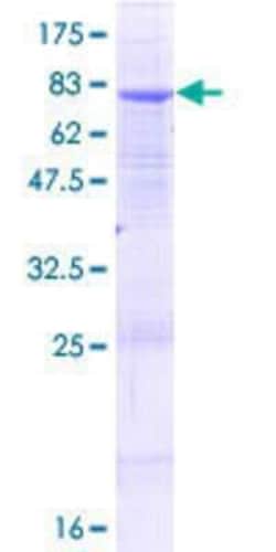 Novus Biologicals Recombinant Human ALG2 GST (N-Term) Protein 10 &mu;g | Buy Online | Novus Biologicals&trade; | Fisher Scientific