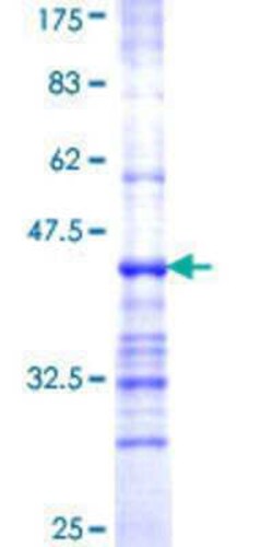 Novus Biologicals Recombinant Human ALG2 GST (N-Term) Protein 10 &mu;g | Buy Online | Novus Biologicals&trade; | Fisher Scientific