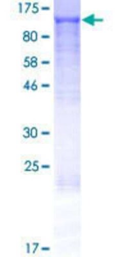 Novus Biologicals Recombinant Human RIMBP3 GST (N-Term) Protein 2 &mu;g | Buy Online | Novus Biologicals&trade; | Fisher Scientific