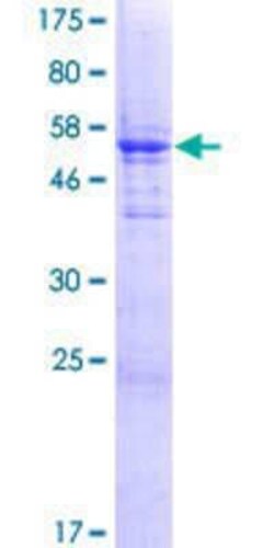Novus Biologicals Recombinant Human ZCRB1 GST (N-Term) Protein 25 &mu;g | Buy Online | Novus Biologicals&trade; | Fisher Scientific