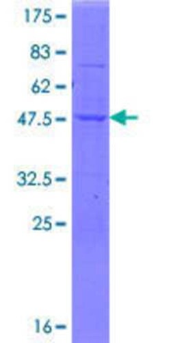 Novus Biologicals Recombinant Human SSH2 GST (N-Term) Protein 10 &mu;g | Buy Online | Novus Biologicals&trade; | Fisher Scientific