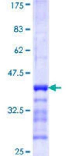 Novus Biologicals Recombinant Human GFM1 GST (N-Term) Protein 10 &mu;g | Buy Online | Novus Biologicals&trade; | Fisher Scientific