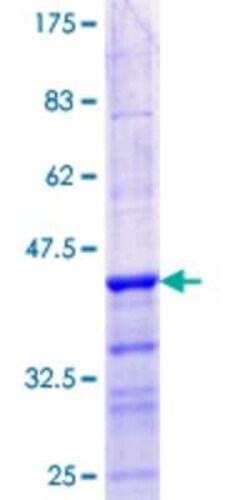 Novus Biologicals Recombinant Human MBD3L1 GST (N-Term) Protein 10 &mu;g | Buy Online | Novus Biologicals&trade; | Fisher Scientific