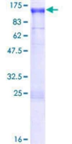 Novus Biologicals Recombinant Human NAV2 GST (N-Term) Protein 10 &mu;g | Buy Online | Novus Biologicals&trade; | Fisher Scientific