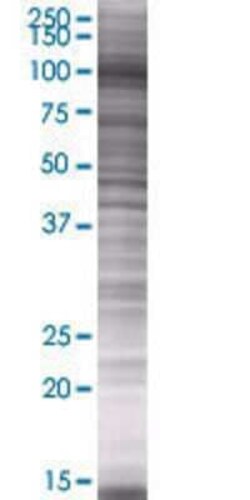 Novus Biologicals&trade;&nbsp;NAV2 293T Cell Transient Overexpression Lysate
