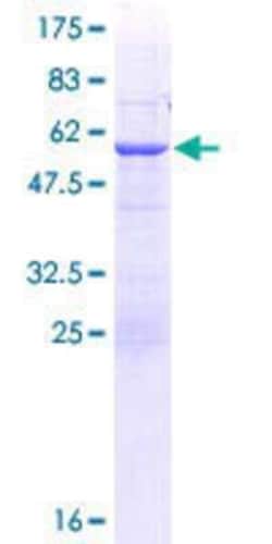 Novus Biologicals Recombinant Human ABCC10 GST (N-Term) Protein 10 &mu;g | Buy Online | Novus Biologicals&trade; | Fisher Scientific