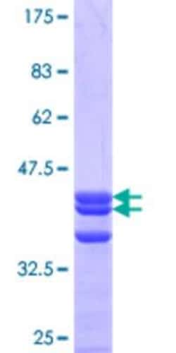 Novus Biologicals Recombinant Human SIGLECL12 GST (N-Term) Protein 10 &mu;g | Buy Online | Novus Biologicals&trade; | Fisher Scientific