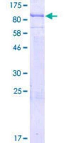 Novus Biologicals Recombinant Human LZTR2 GST (N-Term) Protein 25 &mu;g | Buy Online | Novus Biologicals&trade; | Fisher Scientific