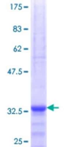 Novus Biologicals Recombinant Human SLC25A21 GST (N-Term) Protein 10 &mu;g | Buy Online | Novus Biologicals&trade; | Fisher Scientific