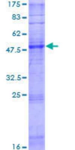Novus Biologicals Recombinant Human OR6W1P GST (N-Term) Protein 25 &mu;g | Buy Online | Novus Biologicals&trade; | Fisher Scientific