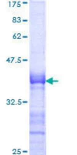 Novus Biologicals Recombinant Human Lhx4 GST (N-Term) Protein 25 &mu;g | Buy Online | Novus Biologicals&trade; | Fisher Scientific