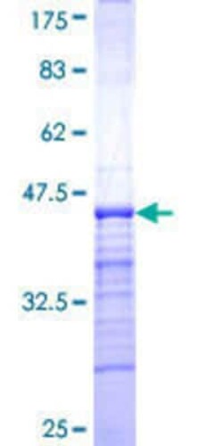 Novus Biologicals Recombinant Human FATE1 GST (N-Term) Protein 25 &mu;g | Buy Online | Novus Biologicals&trade; | Fisher Scientific