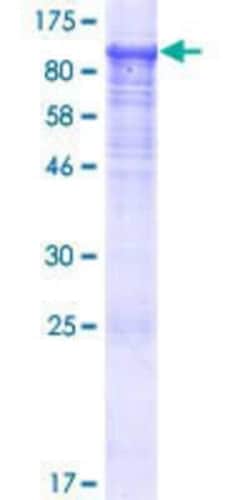 Novus Biologicals Recombinant Human KBTBD6 GST (N-Term) Protein 25 &mu;g | Buy Online | Novus Biologicals&trade; | Fisher Scientific