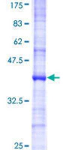 Novus Biologicals™ Recombinant Human UBE3B GST (N-Term) Protein
