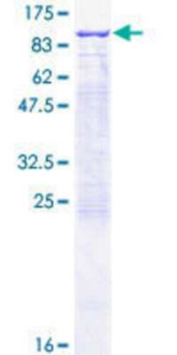 Novus Biologicals Recombinant Human RHOT2 GST (N-Term) Protein 25 &mu;g | Buy Online | Novus Biologicals&trade; | Fisher Scientific