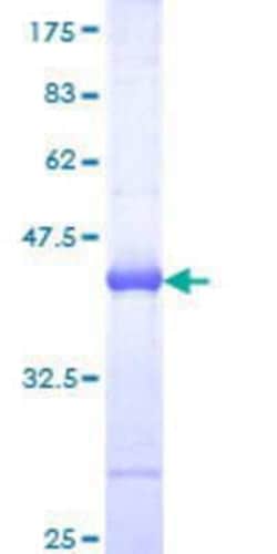 Novus Biologicals Recombinant Human RHOT2 GST (N-Term) Protein 25 &mu;g | Buy Online | Novus Biologicals&trade; | Fisher Scientific