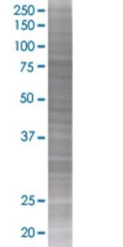 Novus Biologicals&trade;&nbsp;RHOT2 293T Cell Transient Overexpression Lysate