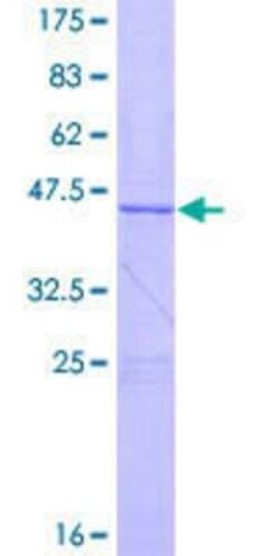 Novus Biologicals Recombinant Human EFCAB11 GST (N-Term) Protein 10 &mu;g | Buy Online | Novus Biologicals&trade; | Fisher Scientific