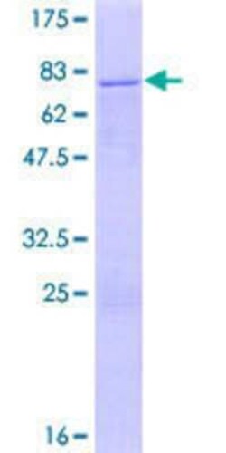 Novus Biologicals Recombinant Human ZNF766 GST (N-Term) Protein 10 &mu;g | Buy Online | Novus Biologicals&trade; | Fisher Scientific