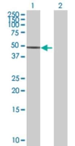 Novus Biologicals ZNF766 293T Cell Transient Overexpression Lysate 0,1 mL | Buy Online | Novus Biologicals&trade; | Fisher Scientific