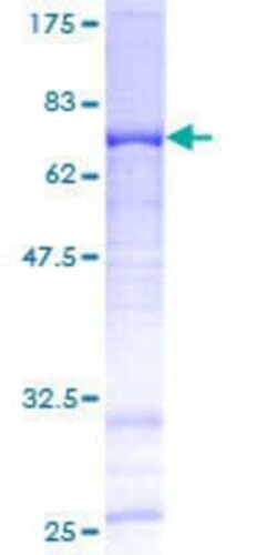 Novus Biologicals Recombinant Human FAM110B GST (N-Term) Protein 2 &mu;g | Buy Online | Novus Biologicals&trade; | Fisher Scientific