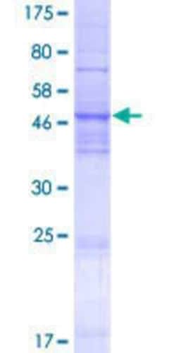 Novus Biologicals Recombinant Human TMEM41A GST (N-Term) Protein 25 &mu;g | Buy Online | Novus Biologicals&trade; | Fisher Scientific