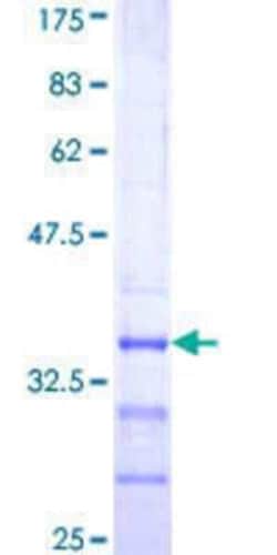 Novus Biologicals Recombinant Human ATP6V1E2 GST (N-Term) Protein 25 &mu;g | Buy Online | Novus Biologicals&trade; | Fisher Scientific