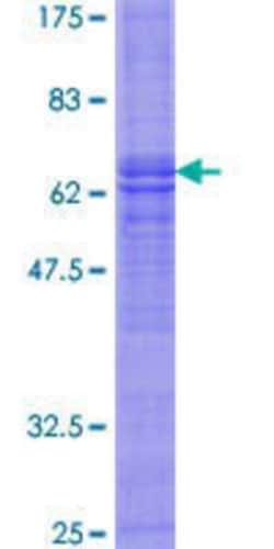 R&D Systems&trade;&nbsp;Recombinant Human NIP GST (N-Term) Protein