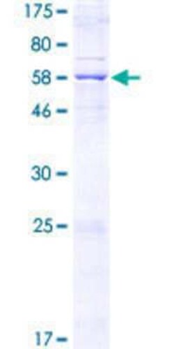Novus Biologicals Recombinant Human CCDC109A GST (N-Term) Protein 2 &mu;g | Buy Online | Novus Biologicals&trade; | Fisher Scientific