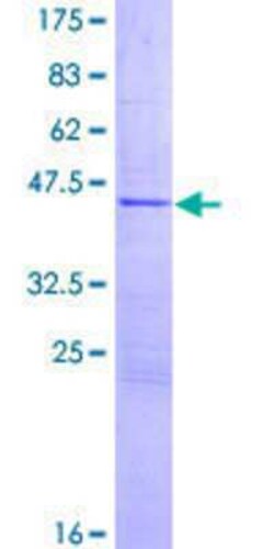 Novus Biologicals Recombinant Human N4BP2L1 GST (N-Term) Protein 25 &mu;g | Buy Online | Novus Biologicals&trade; | Fisher Scientific