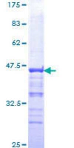 Novus Biologicals Recombinant Human Pygopus-2 GST (N-Term) Protein 25 &mu;g | Buy Online | Novus Biologicals&trade; | Fisher Scientific