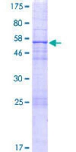 Novus Biologicals Recombinant Human ANGEL2 GST (N-Term) Protein 2 &mu;g | Buy Online | Novus Biologicals&trade; | Fisher Scientific
