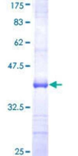 Novus Biologicals Recombinant Human ZNF598 GST (N-Term) Protein 25 &mu;g | Buy Online | Novus Biologicals&trade; | Fisher Scientific