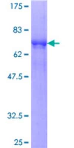 Novus Biologicals Recombinant Human SPSB3 GST (N-Term) Protein 10 &mu;g | Buy Online | Novus Biologicals&trade; | Fisher Scientific