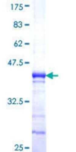 Novus Biologicals Recombinant Human ANKRD30A GST (N-Term) Protein 10 &mu;g | Buy Online | Novus Biologicals&trade; | Fisher Scientific