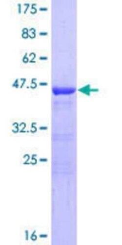 Novus Biologicals Recombinant Human BOD1 GST (N-Term) Protein 25 &mu;g | Buy Online | Novus Biologicals&trade; | Fisher Scientific