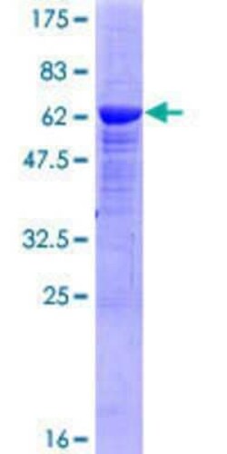 Novus Biologicals Recombinant Human Protein kinase-like protein SgK493 GST (N-Term) Protein 25 &mu;g | Buy Online | Novus Biologicals&trade; | Fisher Scientific