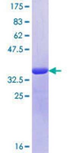 Novus Biologicals Recombinant Human UBXD5 GST (N-Term) Protein 10 &mu;g | Buy Online | Novus Biologicals&trade; | Fisher Scientific
