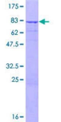 Novus Biologicals Recombinant Human CCDC16 GST (N-Term) Protein 25 &mu;g | Buy Online | Novus Biologicals&trade; | Fisher Scientific