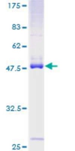 Novus Biologicals Recombinant Human RASL10B GST (N-Term) Protein 25 &mu;g | Buy Online | Novus Biologicals&trade; | Fisher Scientific