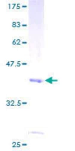 Novus Biologicals Recombinant Human CHURC1 GST (N-Term) Protein 25 &mu;g | Buy Online | Novus Biologicals&trade; | Fisher Scientific