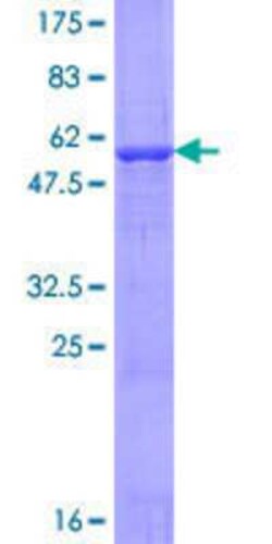 Novus Biologicals Recombinant Human ATPAF2 GST (N-Term) Protein 10 &mu;g | Buy Online | Novus Biologicals&trade; | Fisher Scientific