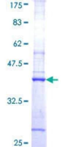 Novus Biologicals Recombinant Human ATPAF2 GST (N-Term) Protein 25 &mu;g | Buy Online | Novus Biologicals&trade; | Fisher Scientific