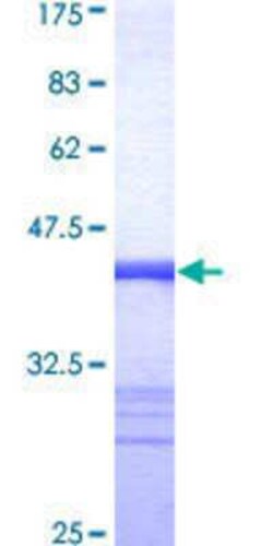 Novus Biologicals Recombinant Human NALP12 GST (N-Term) Protein 25 &mu;g | Buy Online | Novus Biologicals&trade; | Fisher Scientific